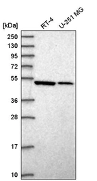 Western blot analysis in human cell line RT-4 and human cell line U-251 MG.