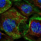 Immunofluorescent staining of human cell line A-431 shows localization to actin filaments.