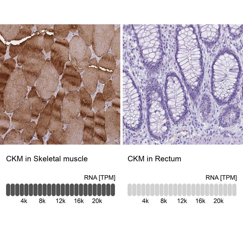 Anti-CKM Antibody