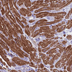 Immunohistochemical staining of human heart muscle shows strong cytoplasmic positivity in cardiomyocytes.