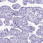 Immunohistochemical staining of human placenta shows no positivity in trophoblastic cells as expected.
