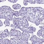 Immunohistochemical staining of human placenta shows no positivity in trophoblastic cells as expected.