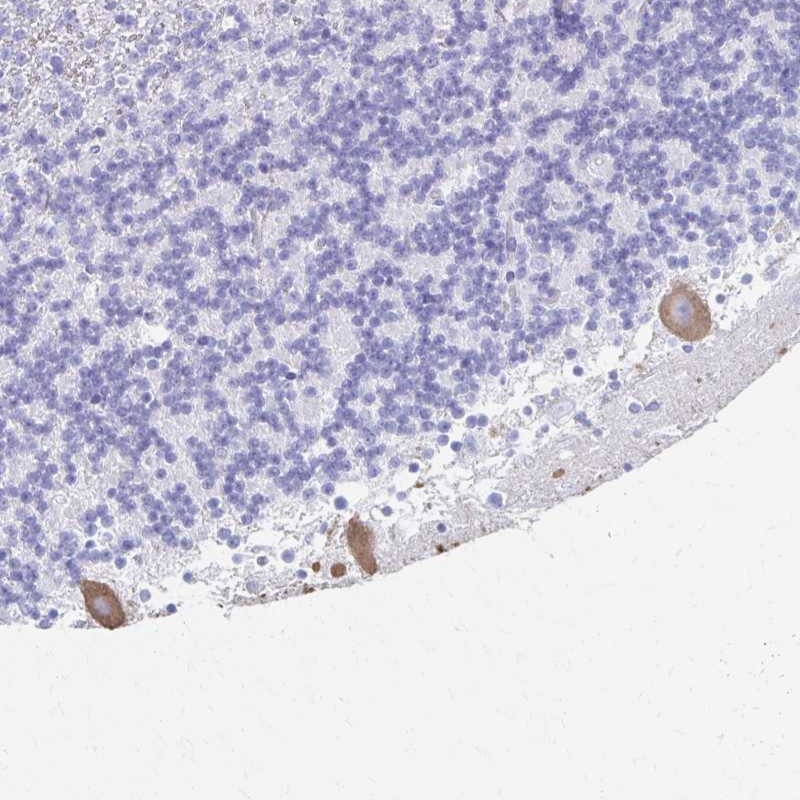 Anti-PRKCG Antibody
