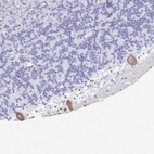 Anti-PRKCG Antibody