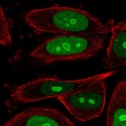 Immunofluorescent staining of human cell line PC-3 shows localization to nucleus & nucleoli.