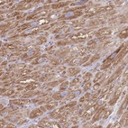 Anti-PDHA1 Antibody