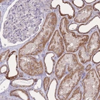 Immunohistochemical staining of human kidney shows strong cytoplasm granular positivity in cells in tubules.