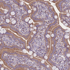 Immunohistochemical staining of human duodenum shows moderate cytoplasm granular positivity in glandular cells.