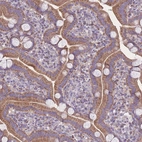 Immunohistochemical staining of human duodenum shows moderate cytoplasm granular positivity in glandular cells.