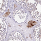 Immunohistochemical staining of human testis shows strong cytoplasm granular positivity in Leydig cells.