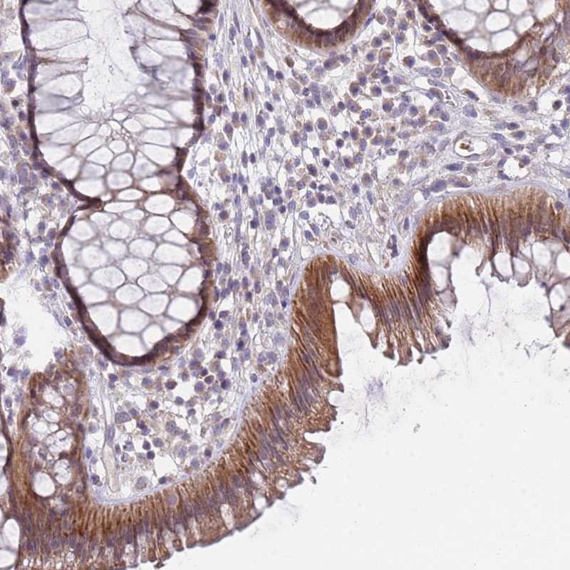 Anti-PRAC1 Antibody