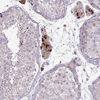 Immunohistochemical staining of human testis shows strong cytoplasmic positivity in Leydig cells.