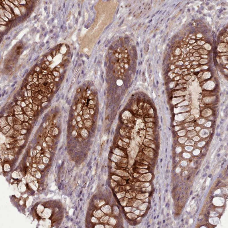 Anti-LEFTY1 Antibody