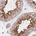 Anti-TBX10 Antibody