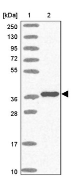 Lane 1: Marker [kDa] 250, 130, 95, 72, 55, 36, 28, 17, 10_br/_Lane 2: Human cell line RT-4