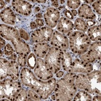Anti-PATZ1 Antibody
