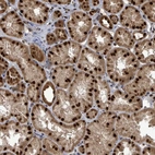 Anti-PATZ1 Antibody