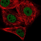 Immunofluorescent staining of human cell line MCF7 shows localization to nucleoplasm.