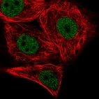 Immunofluorescent staining of human cell line MCF7 shows localization to nucleoplasm.