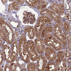 Anti-RASD1 Antibody