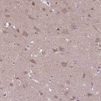 Anti-RASD1 Antibody