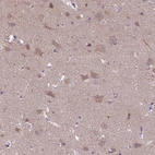 Immunohistochemical staining of human cerebral cortex shows weak cytoplasmic positivity in neurons.