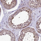 Immunohistochemical staining of human testis shows moderate to strong cytoplasmic, membranous and nuclear positivity in cells in seminiferous ducts.