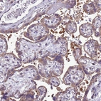 Immunohistochemical staining of human placenta shows moderate cytoplasmic and membranous positivity in trophoblastic cells.