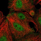 Immunofluorescent staining of human cell line MCF7 shows localization to nucleoplasm & plasma membrane.