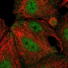 Immunofluorescent staining of human cell line MCF7 shows localization to nucleoplasm & plasma membrane.