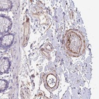 Anti-LEPROTL1 Antibody