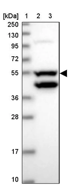 Lane 1: Marker [kDa] 250, 130, 95, 72, 55, 36, 28, 17, 10_br/_Lane 2: Human cell line RT-4_br/_Lane 3: Human cell line U-251MG sp