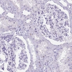 Immunohistochemical staining of human kidney shows low expression as expected.