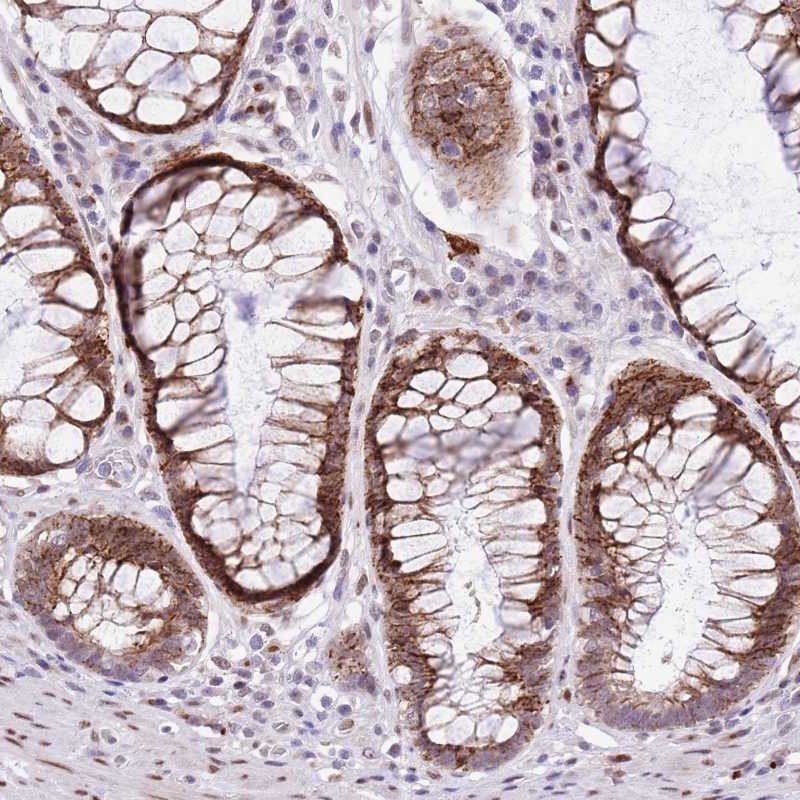 Anti-NACC2 Antibody