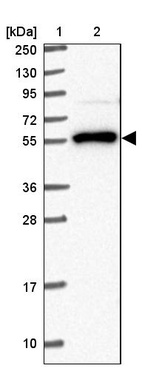 Anti-NACC2 Antibody