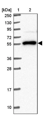 Lane 1: Marker [kDa] 250, 130, 95, 72, 55, 36, 28, 17, 10_br/_Lane 2: Human cell line RT-4