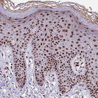 Anti-THOC2 Antibody