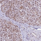 Immunohistochemical staining of human pancreas shows strong nuclear positivity in exocrine glandular cells.
