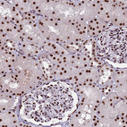 Anti-THOC2 Antibody