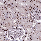 Immunohistochemical staining of human kidney shows strong nuclear positivity in cells in tubules and glomeruli.