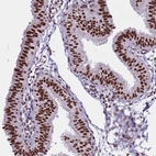 Immunohistochemical staining of human fallopian tube shows strong nuclear positivity in glandular cells.