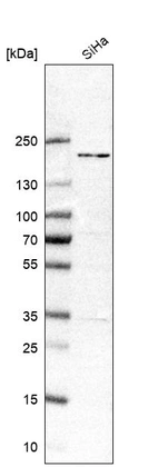 Western blot analysis in human cell line SiHa.