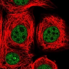 Immunofluorescent staining of human cell line MCF7 shows localization to nucleoplasm.