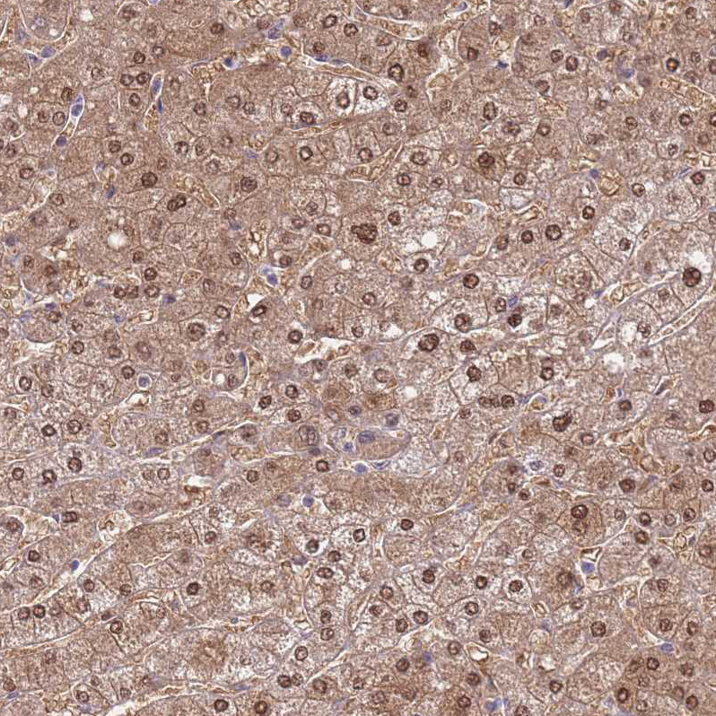 Anti-SEPHS2 Antibody
