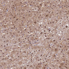 Anti-SEPHS2 Antibody