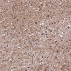 Anti-SEPHS2 Antibody