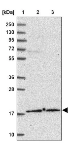 Lane 1: Marker [kDa] 250, 130, 95, 72, 55, 36, 28, 17, 10_br/_Lane 2: Human cell line RT-4_br/_Lane 3: Human cell line U-251MG sp