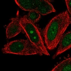 Immunofluorescent staining of human cell line PC-3 shows localization to nucleus & nucleoli.