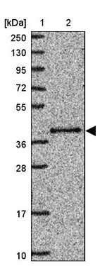 Lane 1: Marker [kDa] 250, 130, 95, 72, 55, 36, 28, 17, 10_br/_Lane 2: Human cell line RT-4