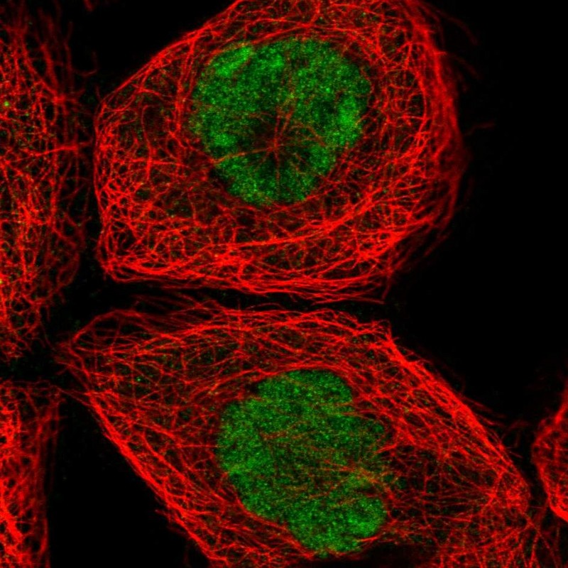 Anti-SPTY2D1 Antibody